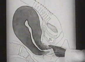 The Science and Art of Obstetrics (Die Wissenschaft und Kunst der Geburtshilfe), 1936, Medicine on Screen / Foto: National Library of Medicine