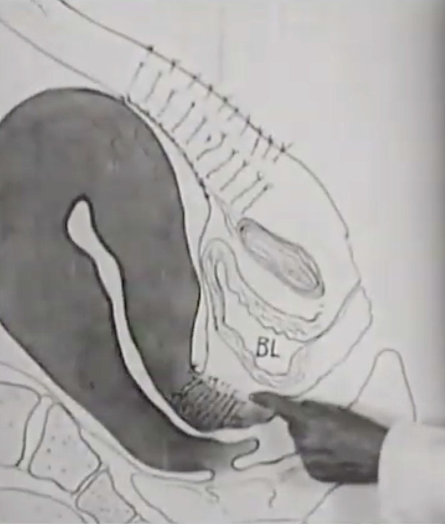 The Science and Art of Obstetrics (Die
                                          Wissenschaft und Kunst der Geburtshilfe), 1936, Medicine on Screen / Foto: National Library of Medicine